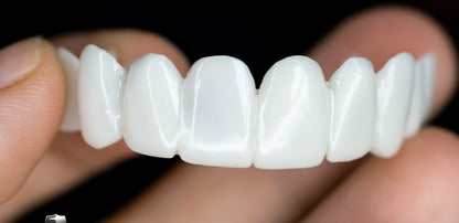 Smile Lens – Verstelbare Witte Tandprothese voor Directe Glimlachcorrectie