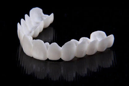Smile Lens – Verstelbare Witte Tandprothese voor Directe Glimlachcorrectie