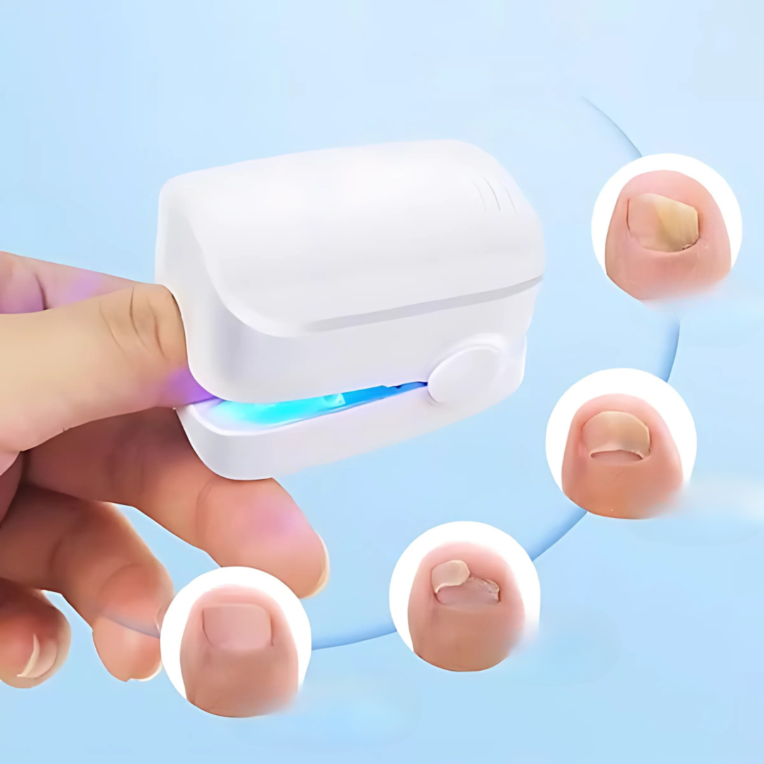 NailClear Laser Nagelschimmel Behandelapparaat – Infrarood Thuisbehandeling