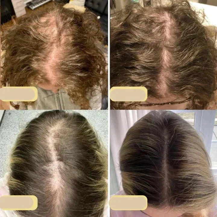 Delopi Veganic | Natuurlijke Haargroei