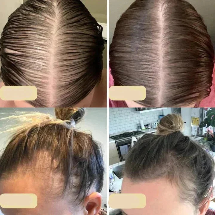 Delopi Veganic | Natuurlijke Haargroei