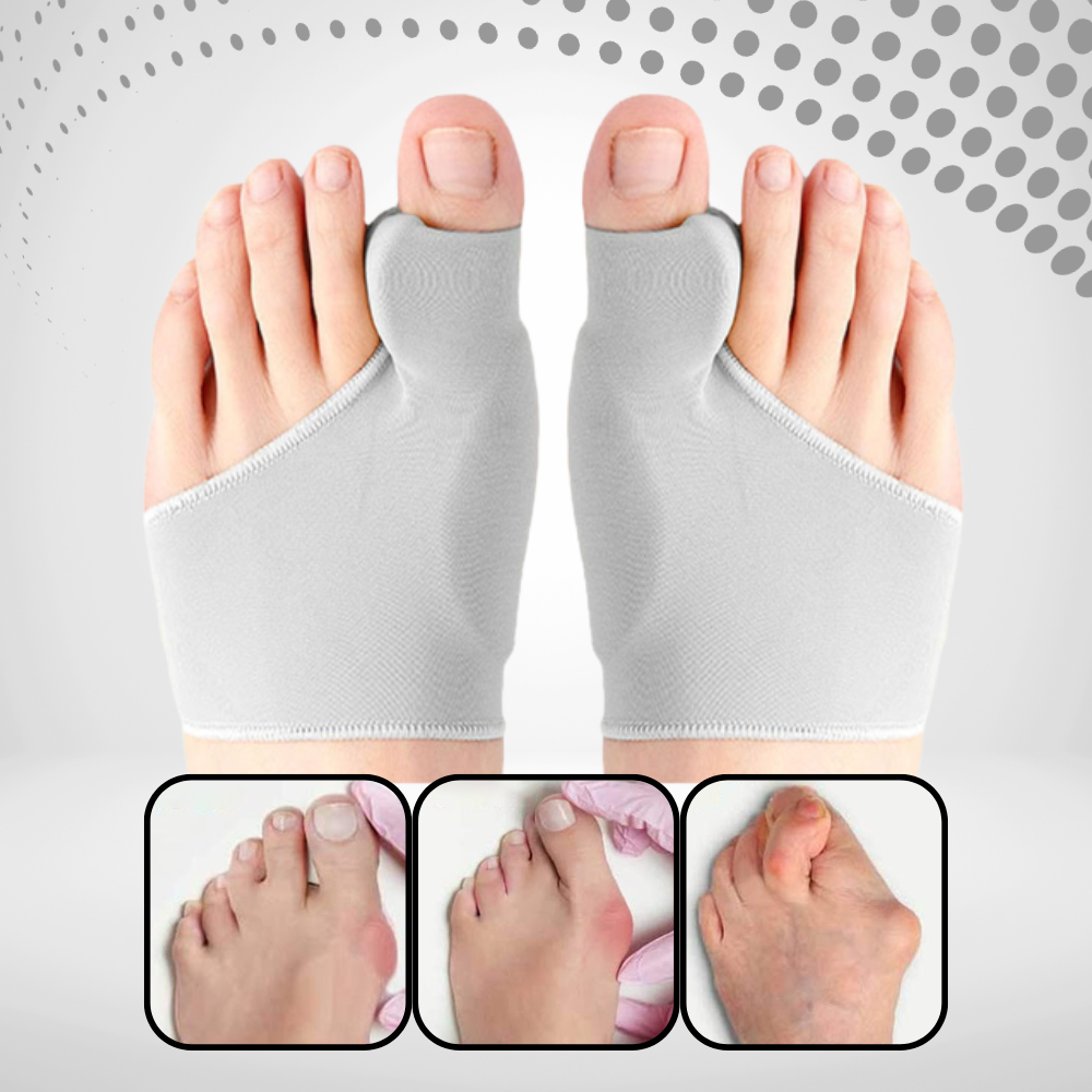 OrthoFix -  Bunion Correctie - Teenseparator - Gelpad voetpijn corrector