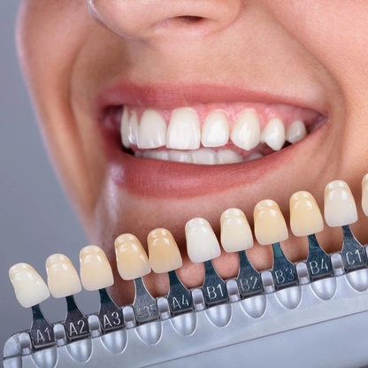 VPSmile™ – Jouw Witte Lach, In Slechts 30 Seconden Per Dag