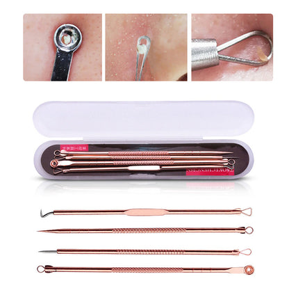 Professionele 4 Delige Mee-eters & Acne Verwijderen Set | Comedonenlepels in luxe opbergcase