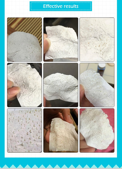 Anti mee-eter crème | Weg met mee-eters | Reinigende Crème | Inclusief 60 strips