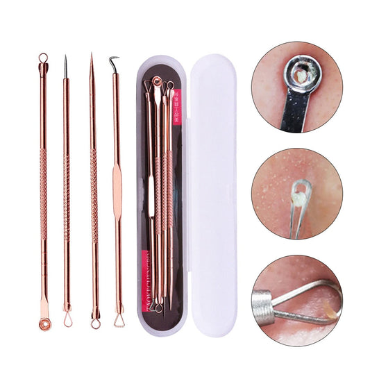 Professionele 4 Delige Mee-eters & Acne Verwijderen Set | Comedonenlepels in luxe opbergcase