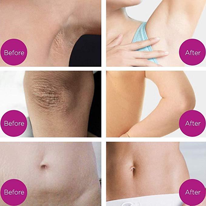 Pure Intimate Whitening Crème - Weg met donkere oksels!
